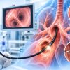 Bronkoskopi Nedir? Hangi Durumlarda Kullanılır?